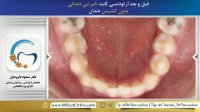 ارتودنسی شمال تهران | متخصص ارتودنسی | دکتر داوودیان