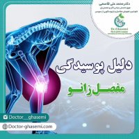 دلیل پوسیدگی مفصل زانو