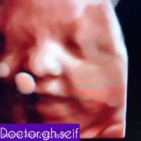 بهترین مرکز سونوگرافی در تهران