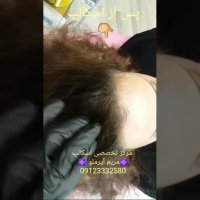 رفع کم پشتی موها در خانم ها