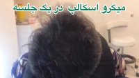 میکرواسکاپ در کلینیک رنسانس
