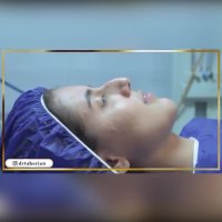 فیلم جراحی زیبایی سپتورینوپلاستی