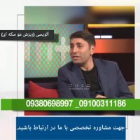 آلوپسی و ریزش مو سکه ای درمان شد