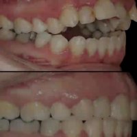 بهترین دکتر ارتودونسی تهران | دکتر داوودیان