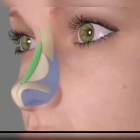 عمل بینی مشهد | 09380000893 انیمیشن نحوه عمل بینی