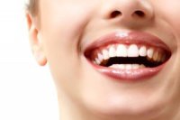 آیا سفید کردن دندان‌ها روش قابل اعتمادی است؟