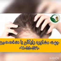 درمان ریزش مو و رویش مجددمو