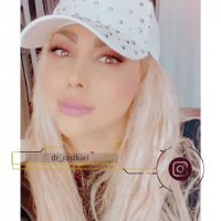 فیلم واقعی از نمونه عمل بینی - رضایت بیمار بعد از 1 سال و نیم