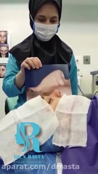 عمل بینی استخوانی غضروفی مراجعه کننده عزیزمون