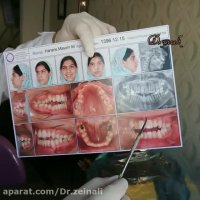 ارتودنسی و اصلاح ناهنجاری