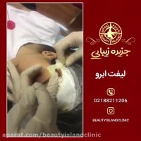 لیفت ابرو-جزیره زیبایی