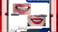 نمونه کارهای زیبایی و درمانی دندانپزشکی بهبد