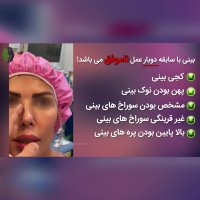 جراحی ترمیمی بینی با سابقه دو بار عمل ناموفق | دکتر باستانی نژاد