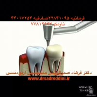 ارتودنسی دندان روکش شده