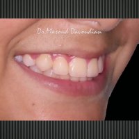 ارتودنسی شمال تهران | متخصص ارتودنسی