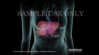 Treatments for Type 1 Diabetes | Nucleus Health
