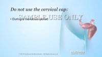 Cervical Cap