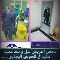 فحص المریض قبل و بعد استبدال عملیه حوض الیساری