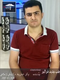 درمان جدید ام اس