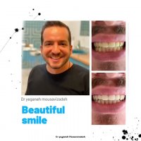 اصلاح طرح لبخند