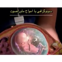انیمیشن سونوگرافی با امواج فراصوت