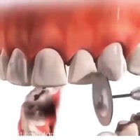 ارتودنسی دندان زیبایی