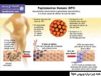 هر آنچه که باید درباره ویروس اچ پی وی hpv  بدانید