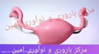 درمان ناباروری با ivf