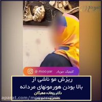 ریزش مو به علت بالا بودن هورمون های مردانه