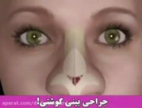جراحی بینی گوشتی