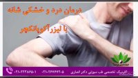 درمان خشکی و درد شانه با لیزرآکوپانکچر