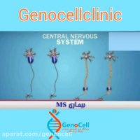 بیماری ام اس چیست؟