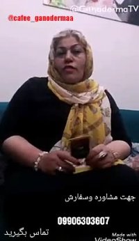 درمان قطعی میگرن سازمان غذا و دارو این دارورا تایید کرد