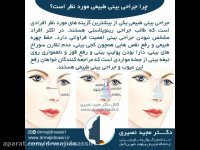 ویژگی های جراحی بینی طبیعی