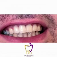 طراحی لبخندی زیبا برای شما