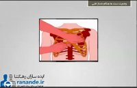 آموزش کمک های اولیه قسمت سوم
