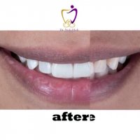 لبخند زیبای یکی دیگر از مراجعه کنندگان عزیزمون