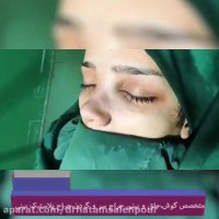 فیلم جراحی بینی