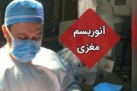 عمل آنوریسم مغزی