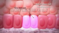 Stem Cells