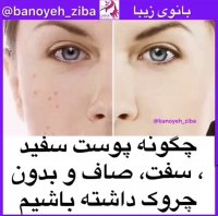 پوست صاف و سفت @banoyeh_ziba