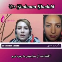 فیلم نتیجه جراحی زیبایی بینی 3 هفته بعد از عمل
