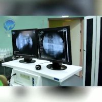 فیلم دیسککتومی لیزری