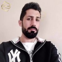 کاشت مو به روشSUT -کلینیک تخصصی رنسانس