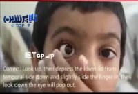 حیرت جهانیان از اختراع محشر پزشک ایرانی