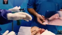 جراحی زیبایی بینی اتاق‌ عمل