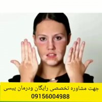 آیا پیسی درمان دارد؟