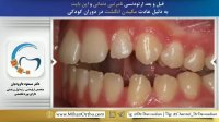 بهترین دکتر ارتودنسی تهران