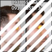 قبل و بعد جراحی زیبایی بینی