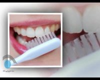 دلایل و درمان بیماری های لثه